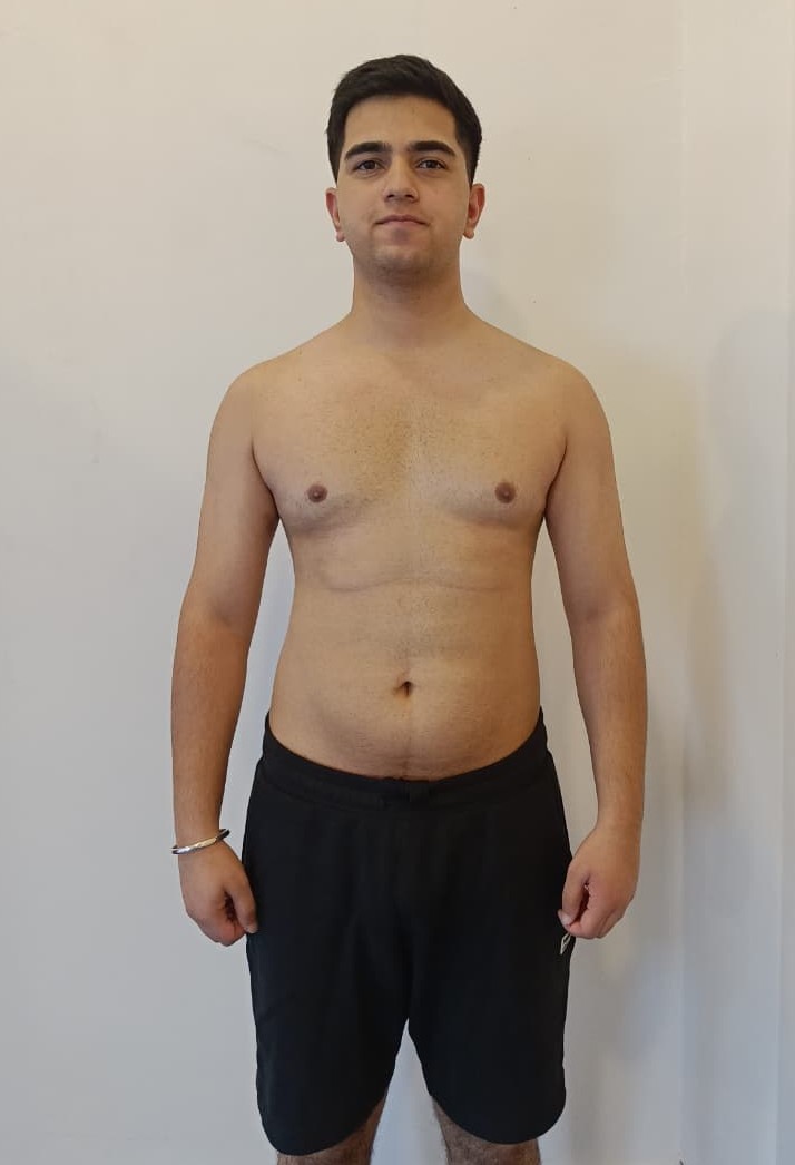 Suraj Thakur — after